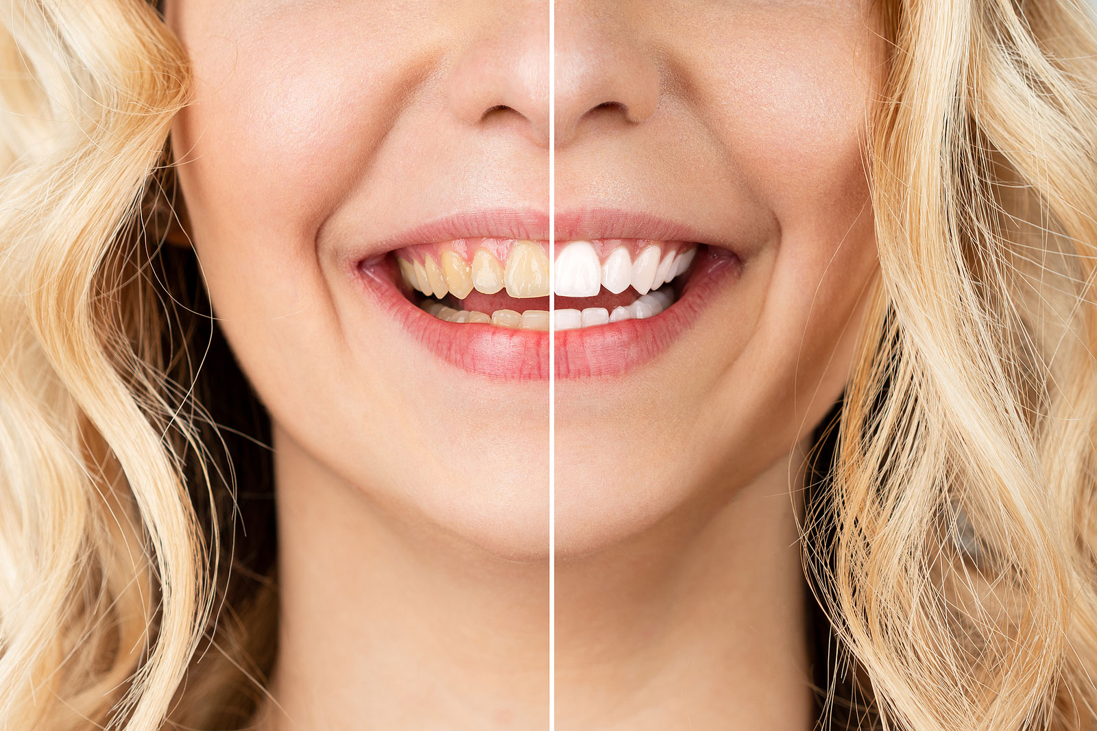 Unlock your Smile’s Potential with a Smile Makeover Consultation at Healthy Dental Expressions